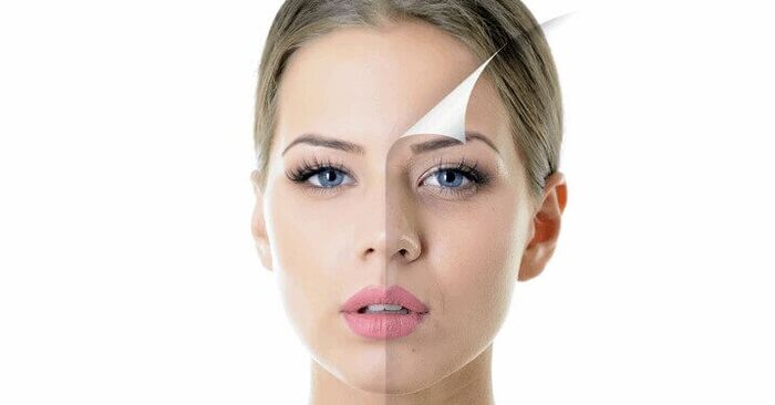 pomlađivanje kože lica kod žena