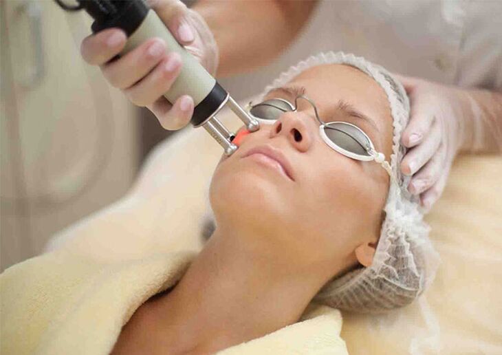 Laserski postupak pomlađivanja kože oko očiju